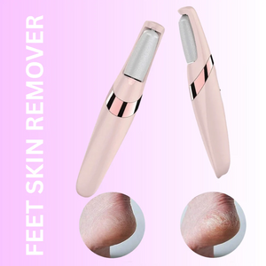 Callus Remover – Portable Foot Care